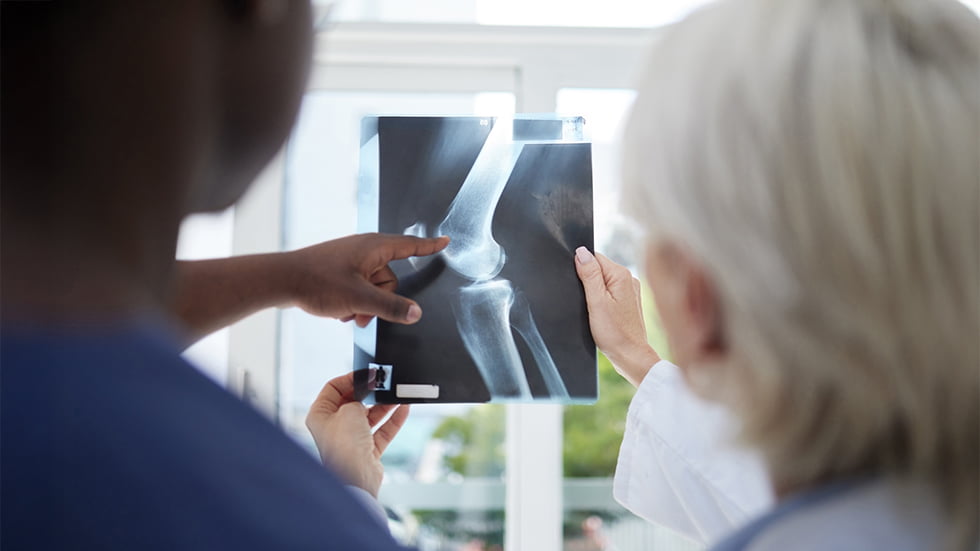 Osteoporosi: un ladro silenzioso