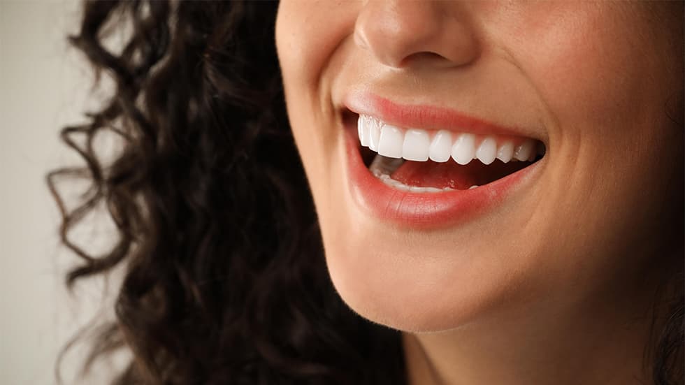 Sbiancamento dentale: come funziona e quanto dura