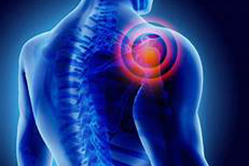 Riabilitazione della spalla, perché la fisioterapia in acqua fa bene?